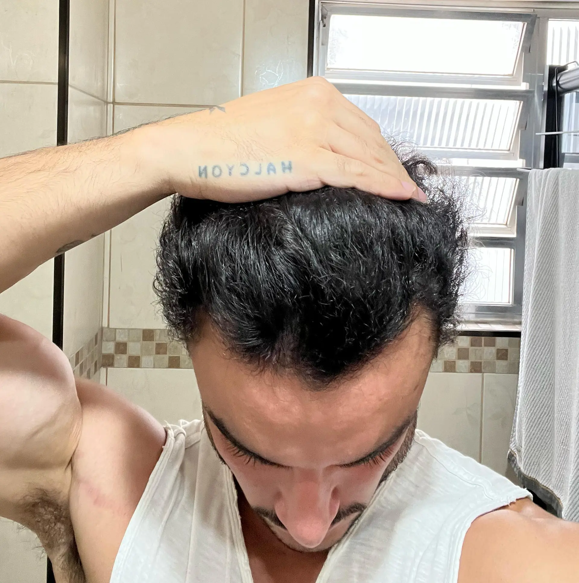 Resultado do tratamento de Carlos M.